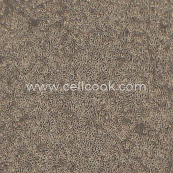 J774A.1小鼠腹水單核細胞瘤細胞（種屬鑒定正確）