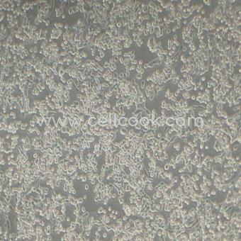 LLC小鼠lewis肺癌細(xì)胞（STR鑒定正確）