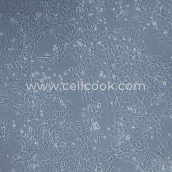 TM3正常小鼠睪丸Leydig細(xì)胞（STR鑒定正確）