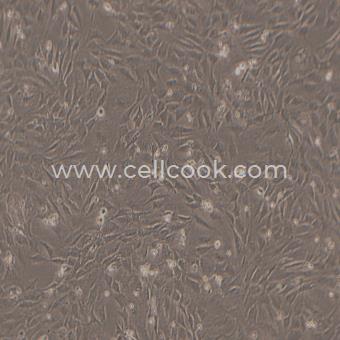 3T3swiss小鼠胚胎成纖維細(xì)胞（STR鑒定正確）