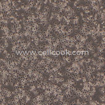 U14小鼠子宮頸癌細(xì)胞（種屬鑒定正確）