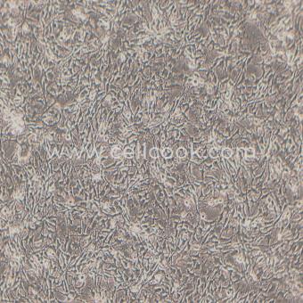 K7M2 wt小鼠骨肉瘤成骨細(xì)胞（種屬鑒定正確）