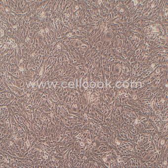 ID8小鼠卵巢上皮細(xì)胞（STR鑒定正確）