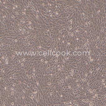 HT22小鼠海馬神經(jīng)元細(xì)胞（STR鑒定正確）