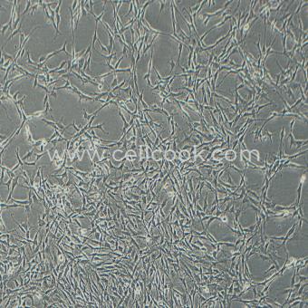 C6大鼠膠質(zhì)瘤細(xì)胞（種屬鑒定正確）