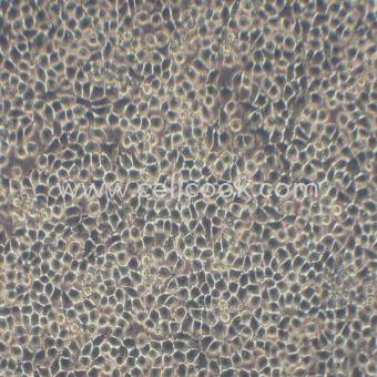 H4-II-E-C3(RH-35)大鼠肝癌細(xì)胞（種屬鑒定正確）