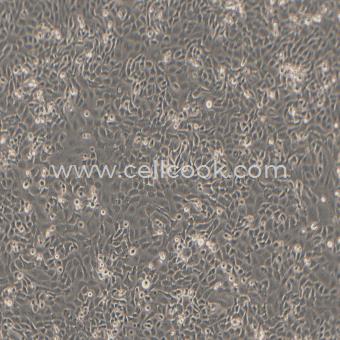 SHZ-88大鼠乳腺癌細(xì)胞（種屬鑒定正確）