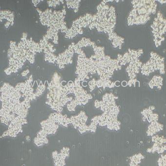 PC-12(未分化)大鼠腎上腺嗜鉻細胞瘤細胞(未分化)（種屬鑒定正確）