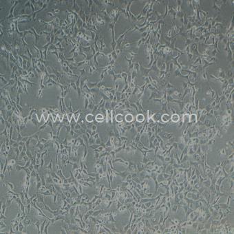 MDBK牛腎細(xì)胞（種屬鑒定正確）