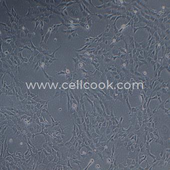 RF/6A猴脈絡(luò)膜-視網(wǎng)膜(內(nèi)皮)細(xì)胞（種屬鑒定正確）