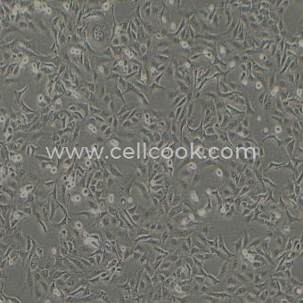 A549-DDP人非小細(xì)胞肺癌細(xì)胞順鉑耐藥株（STR鑒定正確）