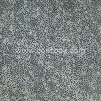 PC9-DDP人非小細(xì)胞肺癌細(xì)胞順鉑耐藥株（STR鑒定正確）