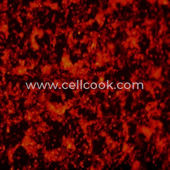 SH-SY5Y-RFP示蹤穩(wěn)定細胞株（STR鑒定正確）