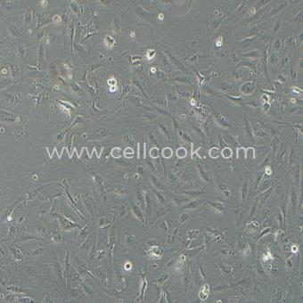 SNU-423人肝癌細(xì)胞（STR鑒定正確）