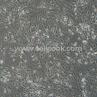 HCCC-9810人膽管細(xì)胞型肝癌細(xì)胞（STR鑒定正確）