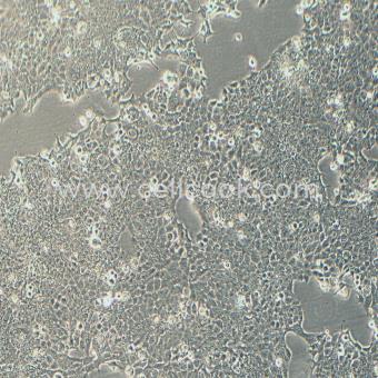 NCI-H1573人非小細(xì)胞肺腺癌細(xì)胞（STR鑒定正確）