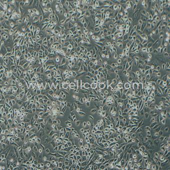 NCI-H1703人肺鱗癌細(xì)胞（STR鑒定正確）