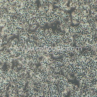 NCI-H3122人肺腺癌細(xì)胞（STR鑒定正確）