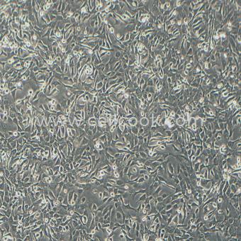 NCI-H1568人非小細(xì)胞肺癌細(xì)胞（淋巴結(jié)）（STR鑒定正確）