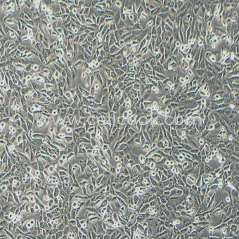 SUM159PT人乳腺癌細胞（STR鑒定正確）