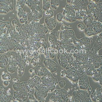 HT-29人結(jié)直腸腺癌細(xì)胞（STR鑒定正確）