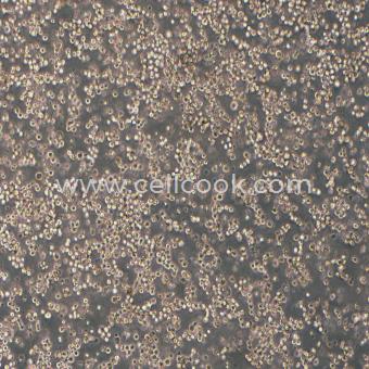 KATO III人胃癌細(xì)胞（STR鑒定正確）