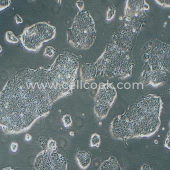 T84人結(jié)腸腺癌肺轉(zhuǎn)移細(xì)胞（STR鑒定正確）