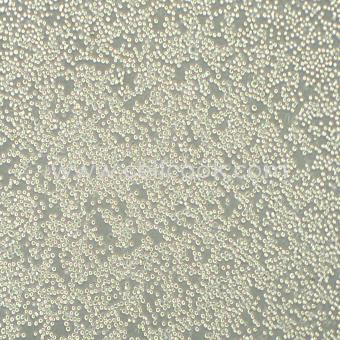 COLO 205人結(jié)直腸腺癌細(xì)胞（STR鑒定正確）