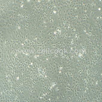 SW626人結(jié)腸腺癌細(xì)胞(卵巢轉(zhuǎn)移)（STR鑒定正確）