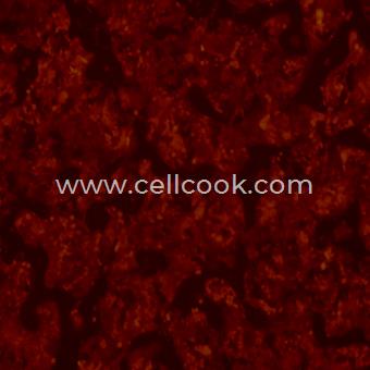 Cal-27-RFP示蹤穩(wěn)定細胞株（STR鑒定正確）