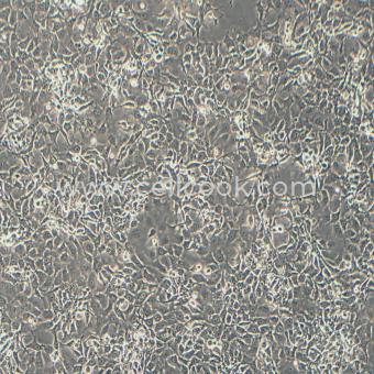 FaDu人咽鱗癌細(xì)胞（STR鑒定正確）