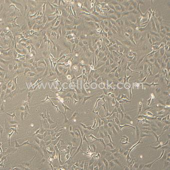 SK-OV-3人卵巢腺癌細(xì)胞（STR鑒定正確）