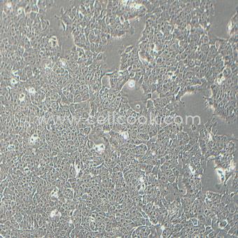 RT4人膀胱移行細(xì)胞乳頭瘤細(xì)胞（STR鑒定正確）