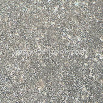 SCaBER人膀胱鱗癌細(xì)胞（STR鑒定正確）