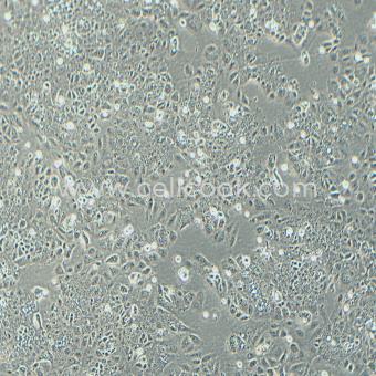 Ishikawa人子宮內(nèi)膜癌細胞（STR鑒定正確）