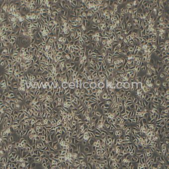 ME-180人子宮頸表皮癌細胞（STR鑒定正確）