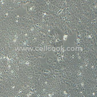 MS751人子宮頸表皮癌細胞（STR鑒定正確）