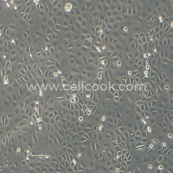 HCC94人子宮鱗癌細胞（高分化）（STR鑒定正確）