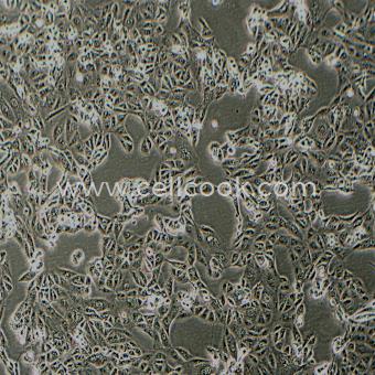 ACHN人腎細(xì)胞腺癌細(xì)胞（STR鑒定正確）