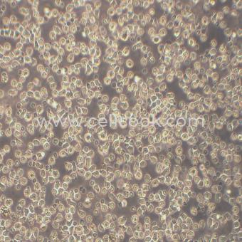 JeKo-1人套細(xì)胞淋巴瘤細(xì)胞（STR鑒定正確）