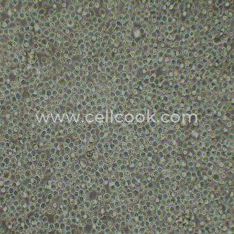 Namalwa人Burkitt's淋巴瘤細(xì)胞（STR鑒定正確）