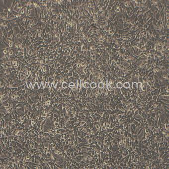 MOG-G-UVW人腦星形膠質(zhì)細(xì)胞瘤細(xì)胞（STR鑒定正確）