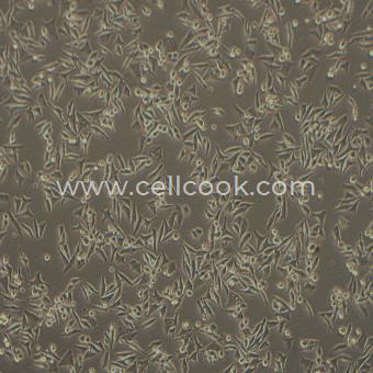 OMM2.5人脈絡(luò)膜黑色素瘤細(xì)胞（肝轉(zhuǎn)移灶）（STR鑒定正確）