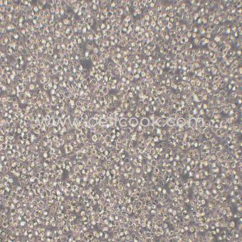 Reh人急性非B非T淋巴細(xì)胞白血病細(xì)胞（STR鑒定正確）