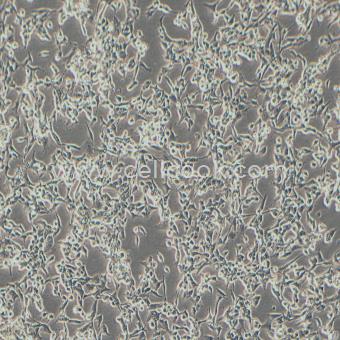 RD人惡性胚胎橫紋肌肉瘤細(xì)胞（STR鑒定正確）