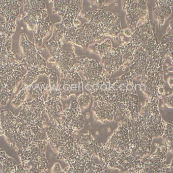 A-673人橫紋肌肉瘤細(xì)胞（STR鑒定正確）