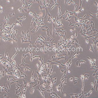 MNNG/HOS Cl #5 [R-1059-D]人骨肉瘤細(xì)胞（STR鑒定正確）