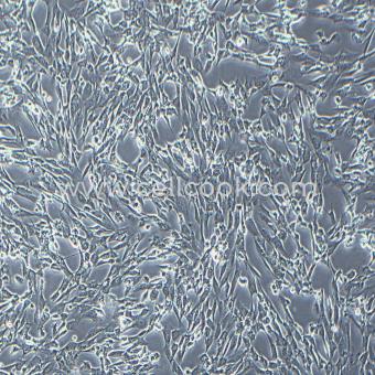SW982人滑膜肉瘤細(xì)胞（STR鑒定正確）