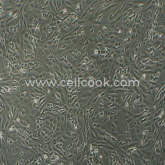 SK-N-SH人神經(jīng)母細(xì)胞瘤細(xì)胞（STR鑒定正確）