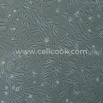 SK-N-BE(2)人神經(jīng)母細(xì)胞瘤細(xì)胞（STR鑒定正確）